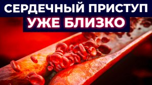 ТИХИЙ УБИЙЦА — атеросклероз! / Как вылечить атеросклероз?