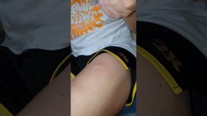 лечение псориаза препаратом эфлейра нетакинаб в онлайн режиме 3й укол