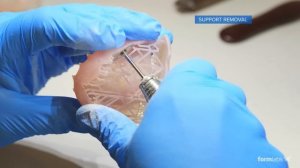 Formlabs Dental: 3D Printed Digital Dentures