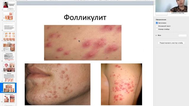 Обучение _дерматология для косметологов -1я часть