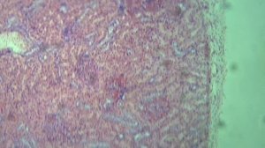 Разбор гистологического препарата №86 Почка