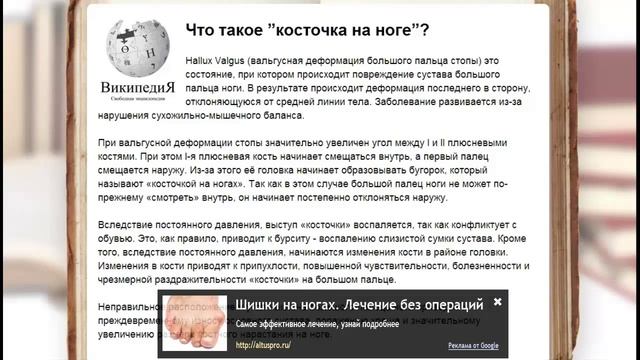 массаж при халюс вальгус / артрит подагра смотреть онлайн