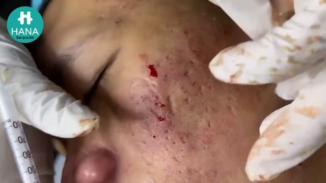 Enjoy Your Day with HANA Spa - Clinic #30 смотреть онлайн