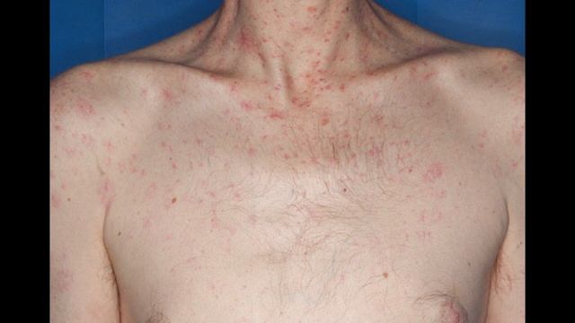 Abdominal Exam OSCE demonstration | Plus detailed guide including pathology and clinical signs смотреть онлайн