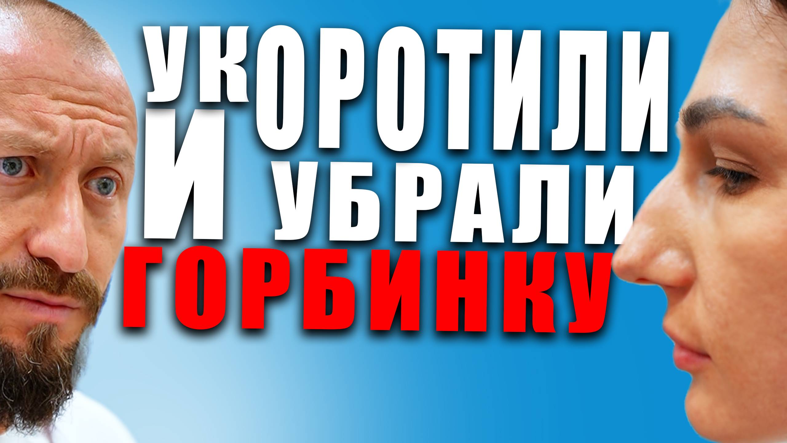 БЕЗ ГЕОМЕТРИИ НОС НОСИКОМ НЕ СДЕЛАЕШЬ / РИНОСЕПТОПЛАСТИКА В МАХАЧКАЛЕ / #ринопластика #пластиканоса