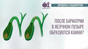 Камни в желчном пузыре после бариатрической операции