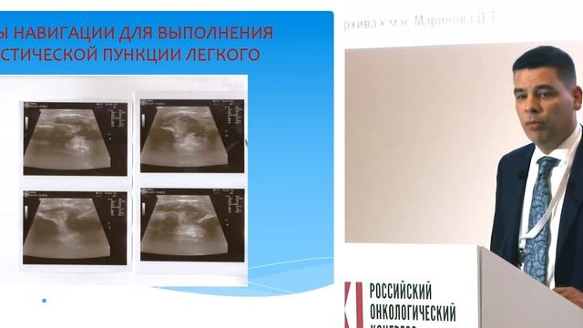 Морфологическая верификация опухолей легких и средостения путем чрескожной тонкоигольной биопсии