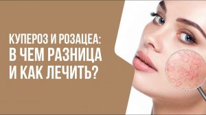 Купероз и розацеа: В ЧЕМ РАЗНИЦА И КАК ЛЕЧИТЬ? | Мнение врача