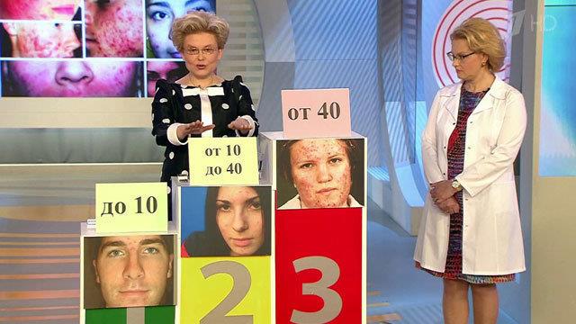 Прыщи. Вторая стадия угревой болезни. Здоровье. Фрагмент выпуска от 13.07.2014