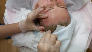 АирисКом студенты учатся: применение нитей Коги для лифтинга височной области.
