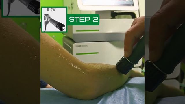 Лікування епікондиліту смотреть онлайн