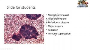 GAME 39 | Actinomycosis | Pathology | Practical slides | Spotters | MBBS | SRM | Dr GSS