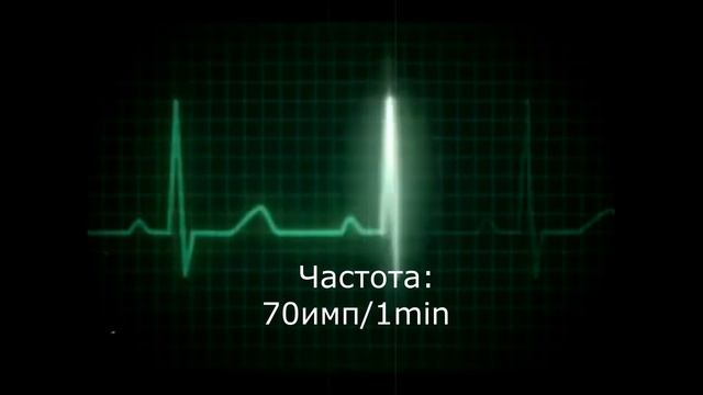 Физиология || АВТОМАТИЯ СЕРДЦА || Физиология Сердца смотреть онлайн