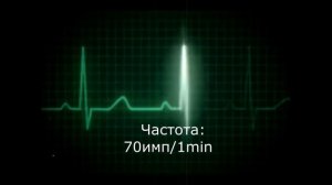 Физиология || АВТОМАТИЯ СЕРДЦА || Физиология Сердца
