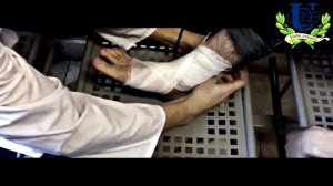 Крестообразная повязка на голеностопный сустав