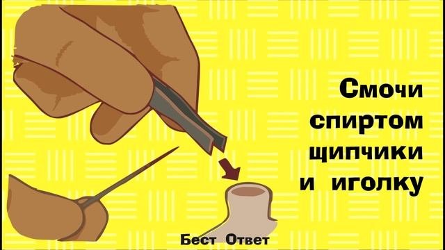 Как вытащить занозу за 1 минуту!? Помощь.