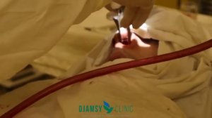 СЕПТОПЛАСТИКА