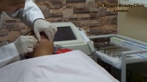 Get Rid of Double Chin- PDO Thread Lift - Dr.Khan's Beauty Clinic. London