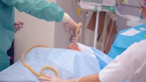 Лазерная липосакция подбородка