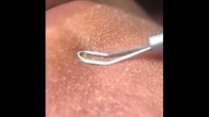 Подборка #ЧИСТКИ Лица