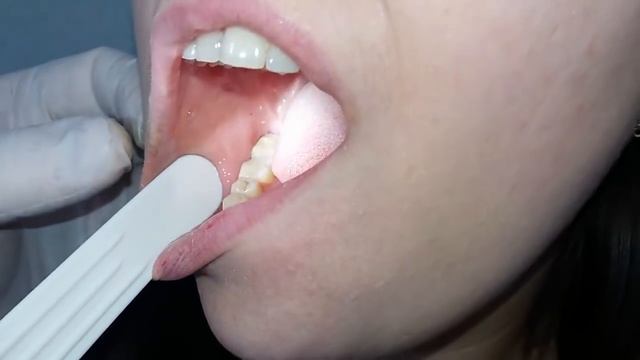 #Видео полость рта и #глотка Образцов Игорь #ЛОР
