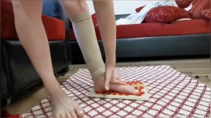 Реабелитация после перелома ноги.Разработка голеностопного сустава. Контрактура