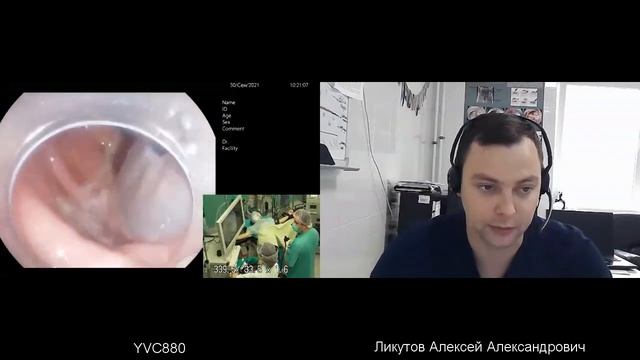 Эндоскопическая мукозэктомия