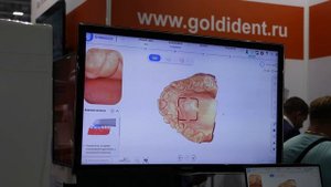 ОБЗОР НА СКАНЕР Aoralscan 3 от Shining 3D