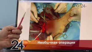 В Казани мужчине оторвало палец обручальным кольцом