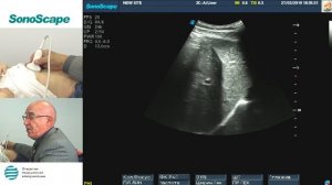 Мастер-класс на аппарате SonoScape S8Exp. Лектор Пыков М.И.