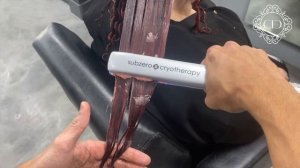 Cryotherapy for the hair with Subzero Cryotherapy Professional