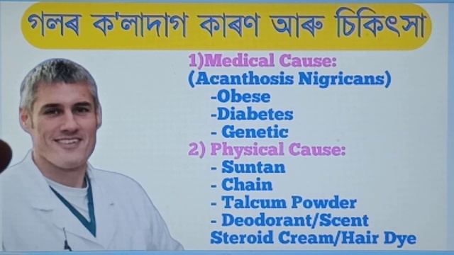 Dark Neck Causes Treatment and Home Remedies | How to get rid of dark neck | Real Thinker смотреть онлайн