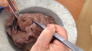 Матка ( Женская половая система. Часть1)
