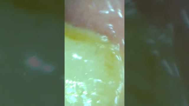 Грязная кожа под микроскопом смотреть онлайн