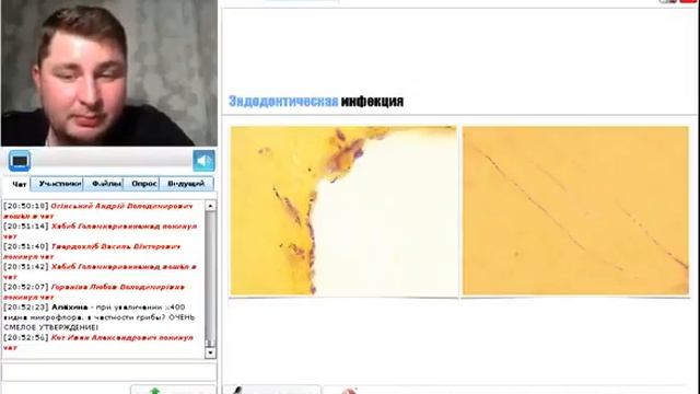 А. Пиголев. Вебинар по эндодонтии. смотреть онлайн