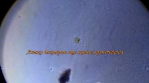 Вода из реки под микроскопом. Жизнь "бурно кипит" в каждой капельке воды