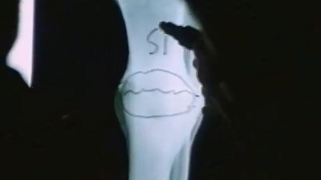 *Кремний - значение для здоровья. Кремния много, доступных форм мало. смотреть онлайн