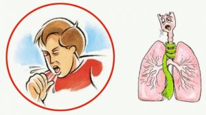 Как избавится от кашля дома