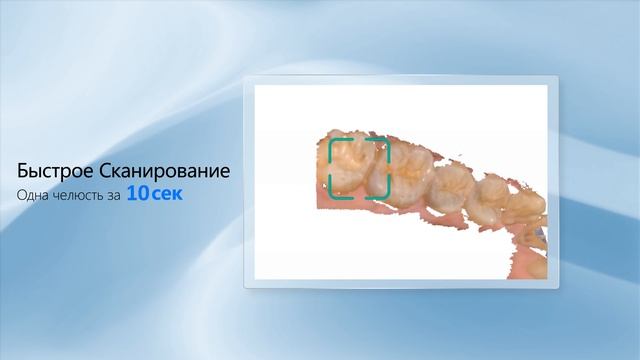 Aoralscan 3 - Новый интраоральный сканер