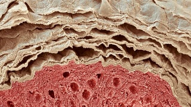 ПРИЧИНЫ АКНЕ | Почему появляются прыщи? | УГРЕВАЯ БОЛЕЗНЬ [ПРОБЛЕМНАЯ КОЖА] Doctor SkinExpert