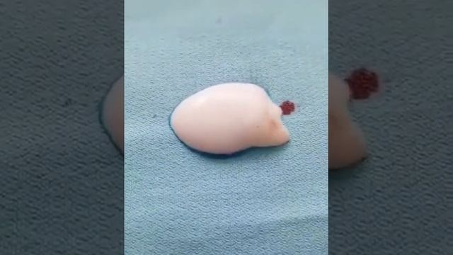 как убрать кровь? смотреть онлайн