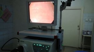 Эндоскопия желудка, ЭГДС, ФГДС, Ошкозони текшириш усули