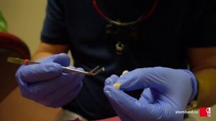 Реальная стоматология! Изготовление временных виниров в клинике "Стоматология БЕСТ"