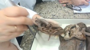 Анатомия | Сердце