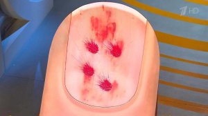 Что скрывает лак для ногтей. Жить здорово! Фрагмент выпуска от 28.04.2016