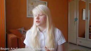 Альбинос деген кім? Кто такой альбинос?