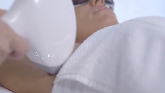 Лазерная эпиляция Еlysion pro смотреть онлайн