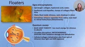 UPDATED_ Improving Eye Health Through a Quantum Lens, Using Circadian Principles.