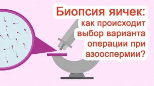 Биопсия яичек: как происходит выбор варианта операции при азооспермии? / Доктор Черепанов