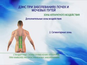 ДЭНАС аппараты и заболевания почек и мочевых путей